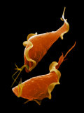 The Parasitic Protozoa Trichomonas Vaginalis Is the Cause of Vaginitis Photographic Print by David Phillips