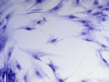 Lung Fibroblast Cells Photographie par Michael Gabridge