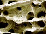 Human Femur Spongy or Cancellous Bone Photographic Print by Fred Hossler