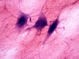 Multipolar Neurons Showing Dendrites, Cell Bodies, and Axons Photographic Print