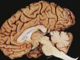 Human Brain Sagittal Section Photographie par Fred Hossler