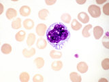 Human Monocyte Leukocyte or White Blood Cell Surrounded by Red Blood Cells Photographic Print by Gladden Willis