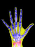 X-Ray of a Human Adult Hand Photographic Print by Barry Slaven