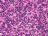 A Normal Human Lymph Node Showing Small, Dark Lymphocytes in the Cortex, H&E Stain Photographic Print by Gladden Willis