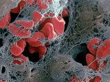 Blood Clot Formation, Showing Trapped Red Blood Cells or Erythrocytes in Fibrin Lámina fotográfica por David Phillips