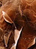 The Surface of Human Skin Epidermis Photographic Print by David Phillips