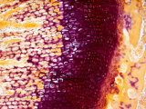 Bone Endochondral Ossification Photographic Print by David Phillips