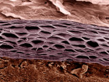 Cross Section of Human Skin Showing the Stratum Corneum Layer of the Epidermis Fotografisk trykk av Veronika Burmeister Cross Section of Human Skin Showing the Stratum Corneum Layer of the Epidermis Fotografisk trykk av Veronika Burmeister