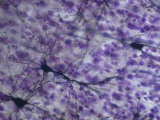 Purkinje Cells of the Cerebellum of the Brain. X60 Photographie par Ralph Hutchings