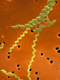 Leptospira Interrogans Is a Spiral-Shaped Bacteria Seen on a Membrane Filter Photographic Print by Tina Carvalho
