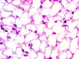 Human White Adipose Tissue or White Fat Tissue, H&E Stain Photographic Print by Gladden Willis