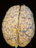 Dorsal Surface of a Human Brain Showing Vasculature Lm Photographic Print by Fred Hossler