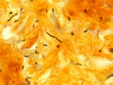 Treponema Pallidum Bacteria in Tissue, the Pathogen of Syphilis. Brightfield Photographie par Michael Abbey