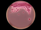 Escherichia Coli Bacteria Colonies on Macconkey Agar Culture Dish. Lactose Fermenters are Red Photographie par Michael Gabridge