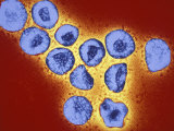 Corona Virus, a Cause of the Common Cold Photographic Print by Gopal Murti