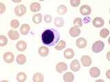 Normal Human Lymphocyte and Red Blood Cells in Peripheral Blood, Wright Stain Photographic Print by Gladden Willis