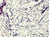 Reticular Fibers, Silver Stain Photographic Print by Richard Kessel