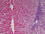 Liver Tissue, Glycogen Stain Photographie par Fred Hossler