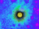 Papilloma Virus Photographic Print by Hans Ackermann
