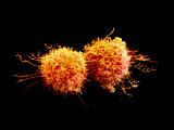 Cancer Cells Dividing Photographie par David Phillips