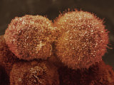 Human Pancreatic Cancer Cell, Cancer Research UK Photographic Print by Anne Weston Human Pancreatic Cancer Cell, Cancer Research UK Photographic Print by Anne Weston
