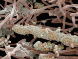 Dental Plaque and Oral Microorganisms Photographic Print by Stanley Flegler