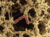 Yogurt Structure, with Bacteria (Lactobacillus Bulgaricus) in Milk Protein Matrix Photographic Print