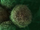 Human Pancreatic Cancer Cell, Cancer Research UK Photographic Print by Anne Weston