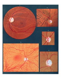 The Eye Seen Through a Microscope, from 'Atlas of Ophthalmoscopy', published in Paris, 1870 Giclee Print by Richard Liebreich