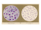 Bacillus of Bubonic Plague - Smear and Culture : Discovered by Yersin at Hong-Kong, 1894, Giclee Print