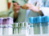 Test Tubes in a Laboratory, Person in Background Photographic Print