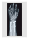 Arm and Finger Repair Wall Decal