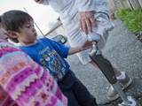 Children Explore the C-Leg Artificial Limb Technology Photographie par Greg Dale