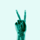 X-Ray of Hand Doing Peace Sign Photographic Print by D. Arky