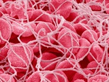 Coagulated Red Blood Cells Photographic Print by Micro Discovery 