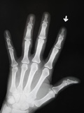 Hand Bones Photographic Print by Simon Jarratt