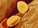 Spores of a Flowering Fern Photographic Print by Micro Discovery 