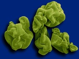 Spirulina Powder Dietary Supplement Fotografisk tryk af Mediscan Spirulina Powder Dietary Supplement Fotografisk tryk af Mediscan