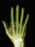 X-ray of Human Hand Photographic Print