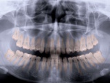 Panoramic X-Ray of Mouth Photographic Print