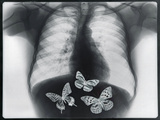 X-ray of butterflies in the stomach Photographic Print by Thom Lang