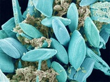 Marine Diatom Reprodukcja zdjęcia autor Micro Discovery