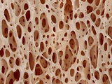 Bone tissue of a hen magnified x25 Photographic Print by Micro Discovery 
