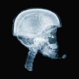 X-ray of skull Photographic Print by David Arky