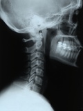 X-Ray of a Human Head Photographie par Philip Kaake