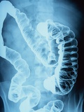 X-Ray of Intestines Photographic Print by Robert Llewellyn