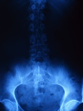 X-Ray of Human Lower Spine Photographic Print by David Frazier