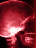 X-Ray of Human Skull Photographic Print