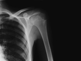 X-ray of a Shoulder Photographic Print by Maxine Hall