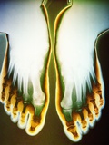 X-ray of Feet Photographie